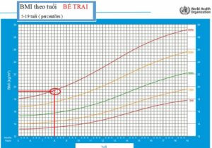 Bé Béo Ở Trẻ Em: Nguyên Nhân, Hệ Lụy Và Hướng Giải Quyết