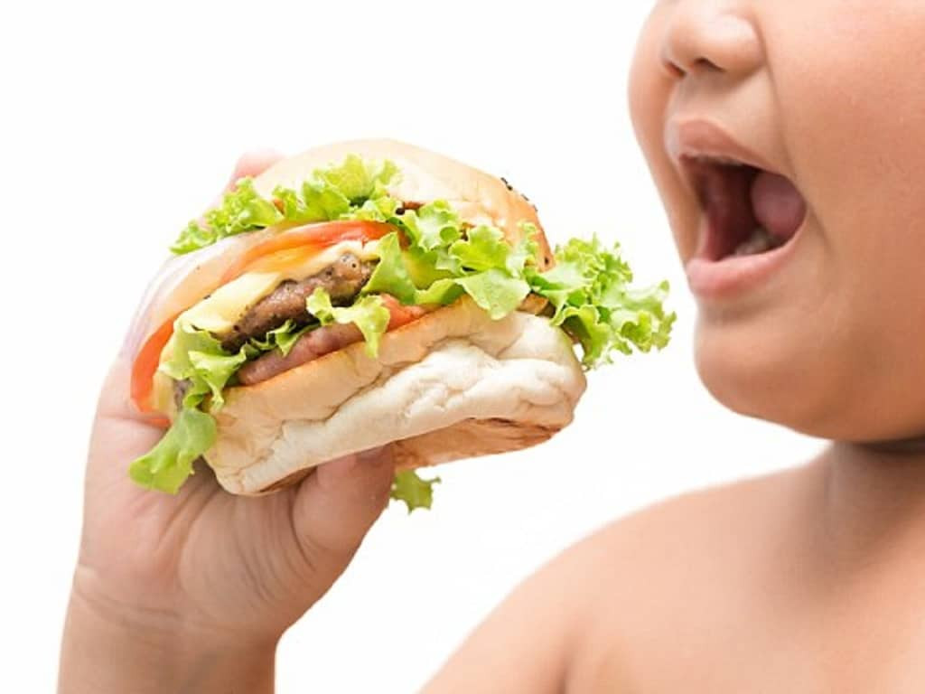 Béo phì: Nguyên nhân,biểu hiện và cách phòng ngừa hiệu quả