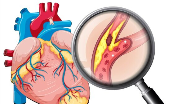 Đạp xe giảm mỡ bụng: Lợi ích và cách thực hiện hiệu quả