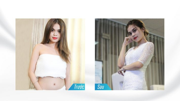 Cách Giảm Mỡ Bụng An Toàn Bằng Nước Gừng